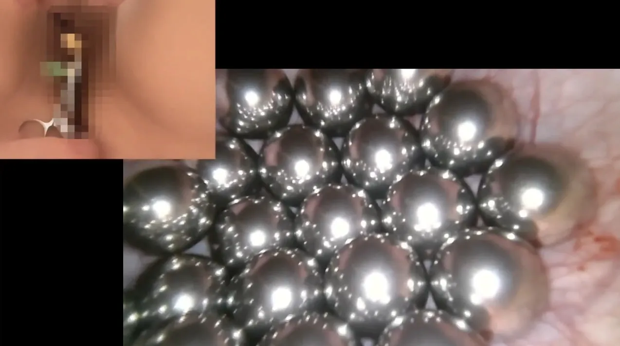 金属球を膀胱に詰めてカメラで覗いて産卵した件