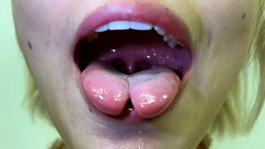 街角で声をかけて口内観察させてもらう 美容部員 はるのちゃん