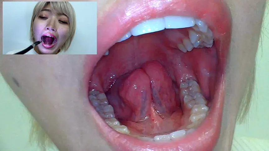 街角で声をかけて口内観察させてもらう 美容部員 はるのちゃん