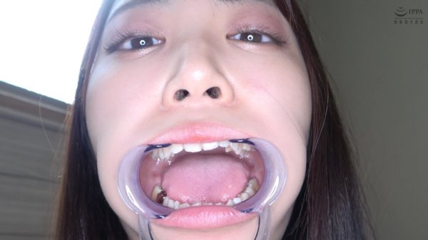 激カワ人気女優 加賀美さら チャンの激レアマウスオープナー着用して口内・歯観察＆電マ当て！