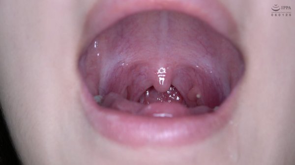 激カワ人気女優 加賀美さら チャンの激レアマウスオープナー着用して口内・歯観察＆電マ当て！