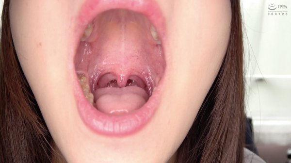 【歯・口内】激カワ女優 あべみかこチャンの舌ベロ・歯・口内・のどちんこ観察★