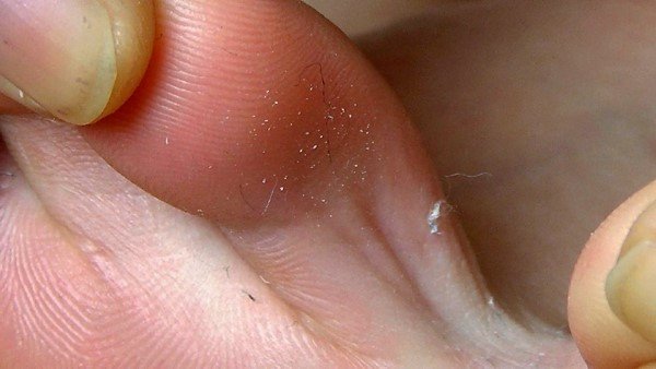 【足のにおい】 コールセンター・足王道